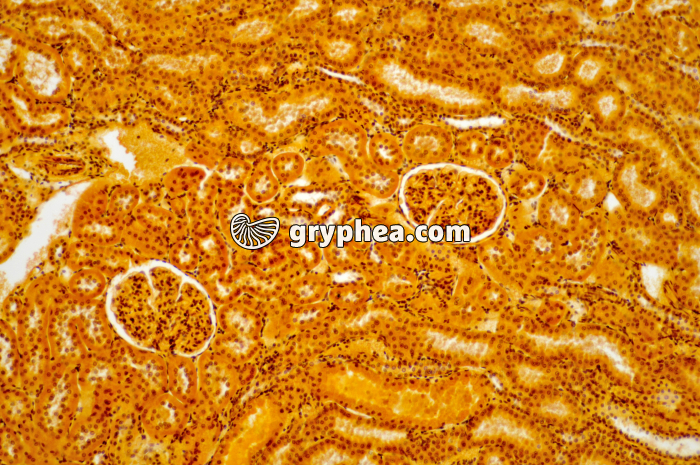 Tubules Rein x40 - gryphea.com